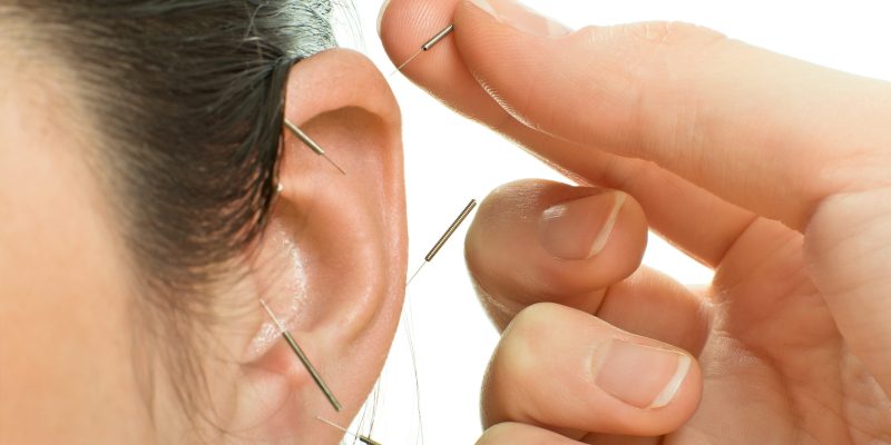 Ohrakupunktur in Hamburg – sanfte Behandlung durch Heilpraktikerin Bettina Zawadzki für mehr Gesundheit und Wohlbefinden