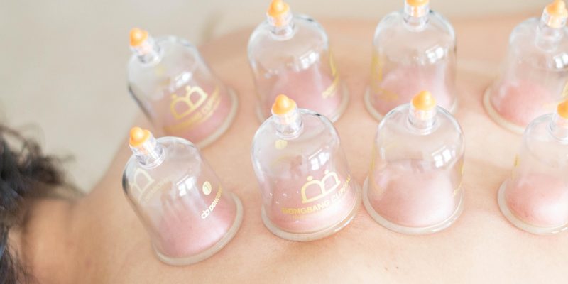 Schröpfen und Humoraltherapie in Hamburg – sanfte Behandlung durch Heilpraktikerin Bettina Zawadzki für mehr Gesundheit und Wohlbefinden